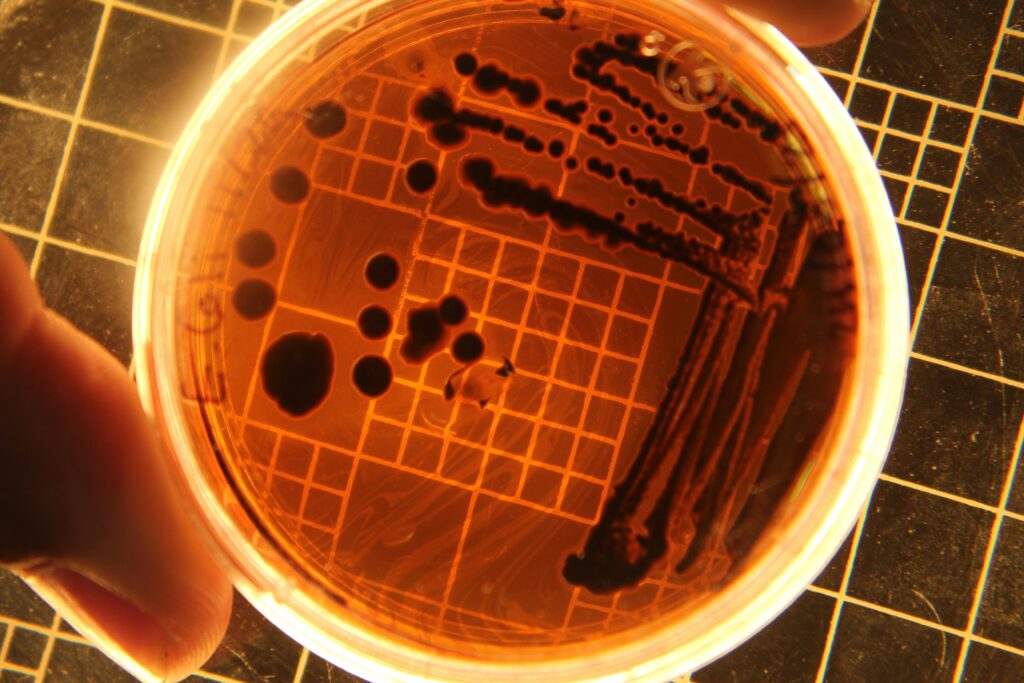 Microbioma Intestinal: O Que É e Por Que Muda Tudo Na Sua Saúde pexels photo 19728524 19728524