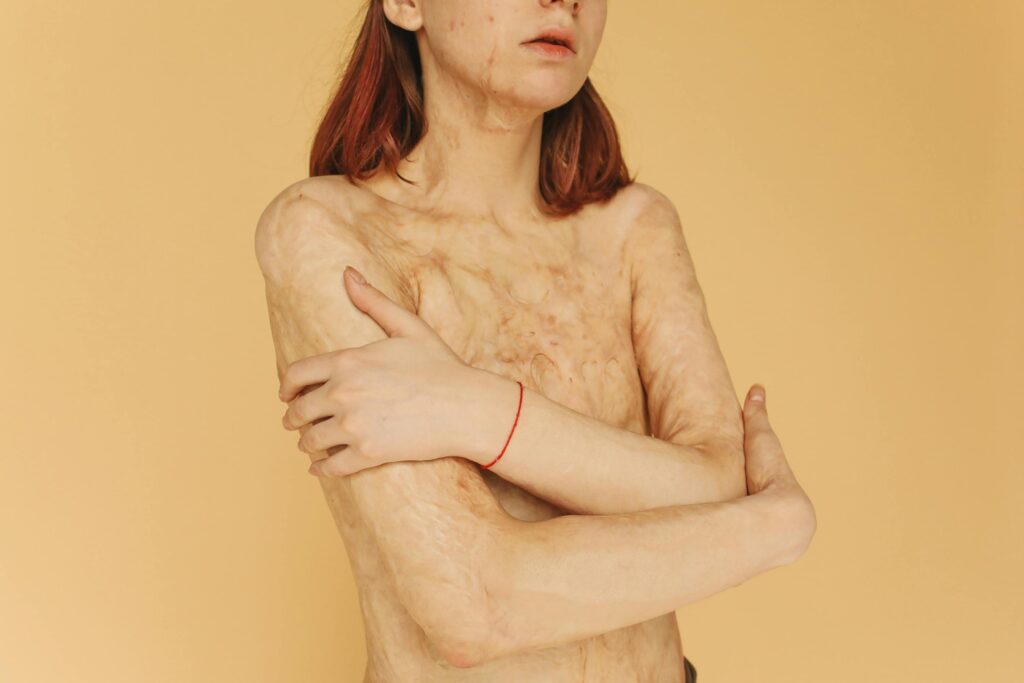 Portrait of a woman embracing her scars on a yellow background.