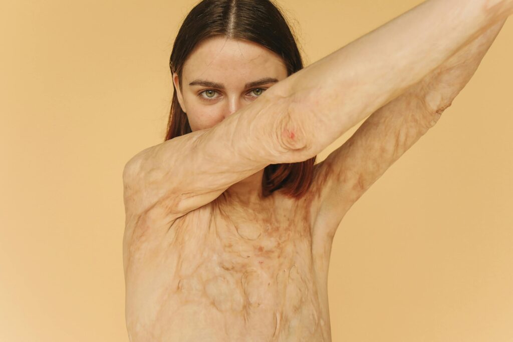 O Perigo Real do Ultraprocessado: O Que Acontece Dentro do Seu Corpo Portrait of a woman confidently showcasing her scars, symbolizing strength and resilience.